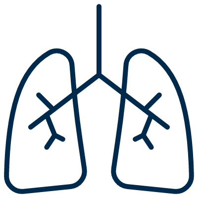 ventilators